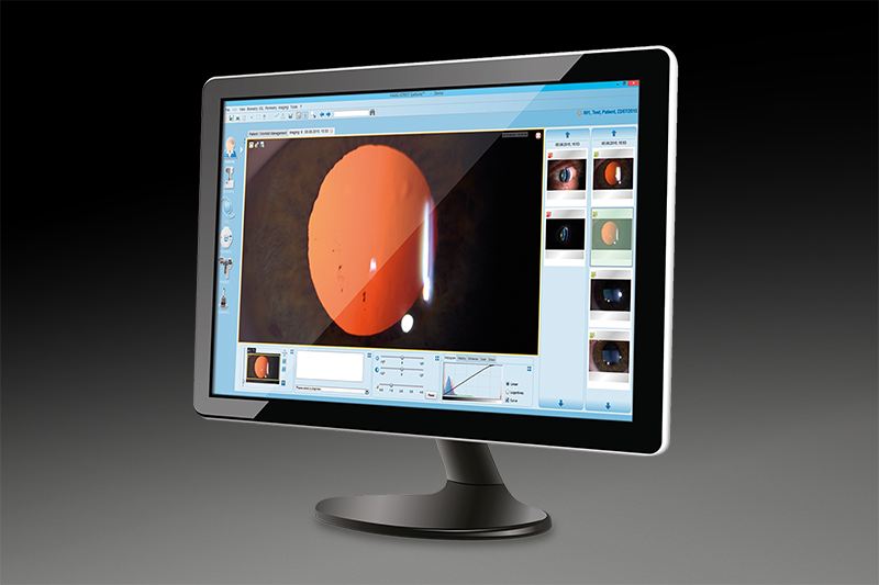 FUNDUS MODULE 300