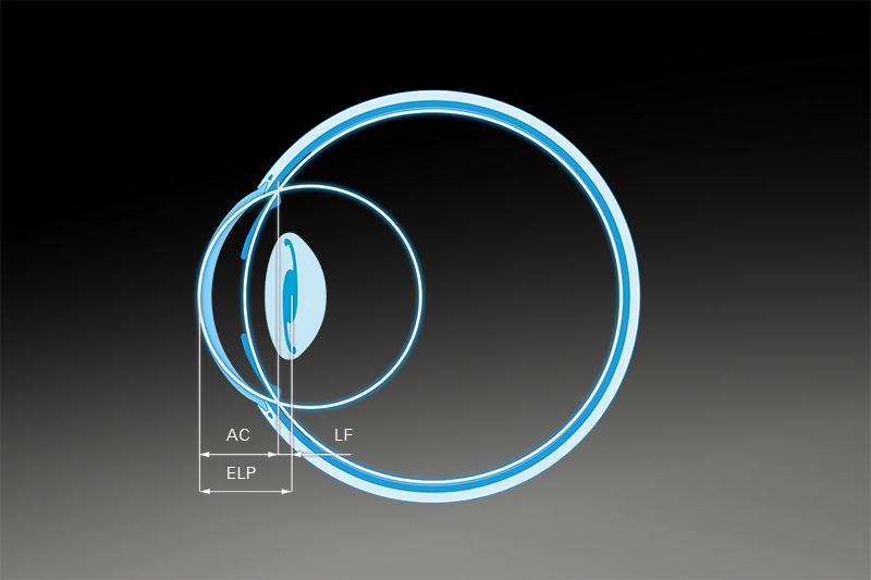 IMPROVED REFRACTIVE OUTCOMES