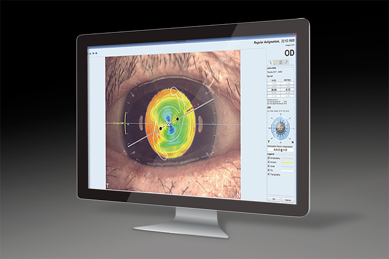 EXCELLENT TORIC RESULTS