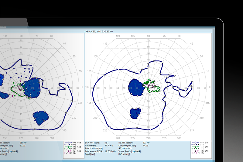 SEMI-AUTOMATED KINETIC PERIMETRY