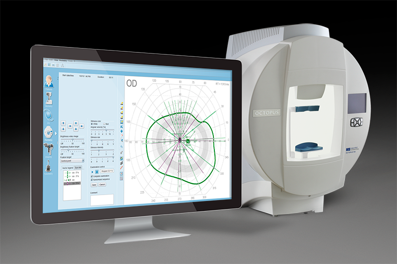 SEMI-AUTOMATED KINETIC PERIMETRY