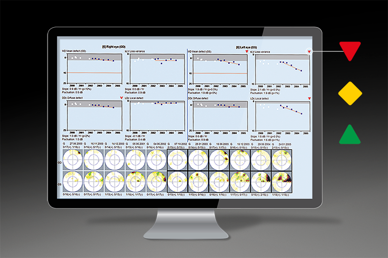 EYESUITE PROGRESSION ANALYSIS