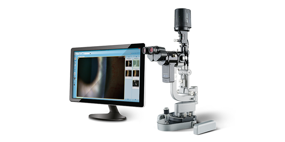 SLIT LAMP IMAGING